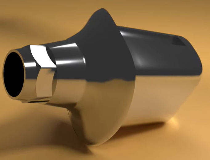 abutment.png